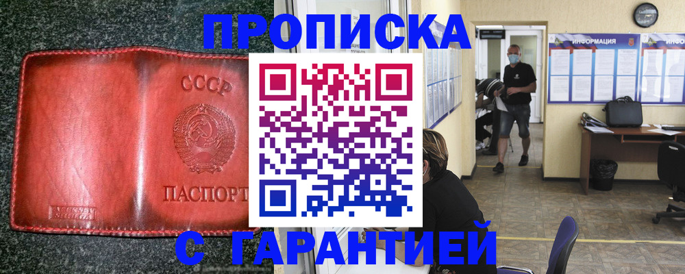 прописка гарантия в Скопине